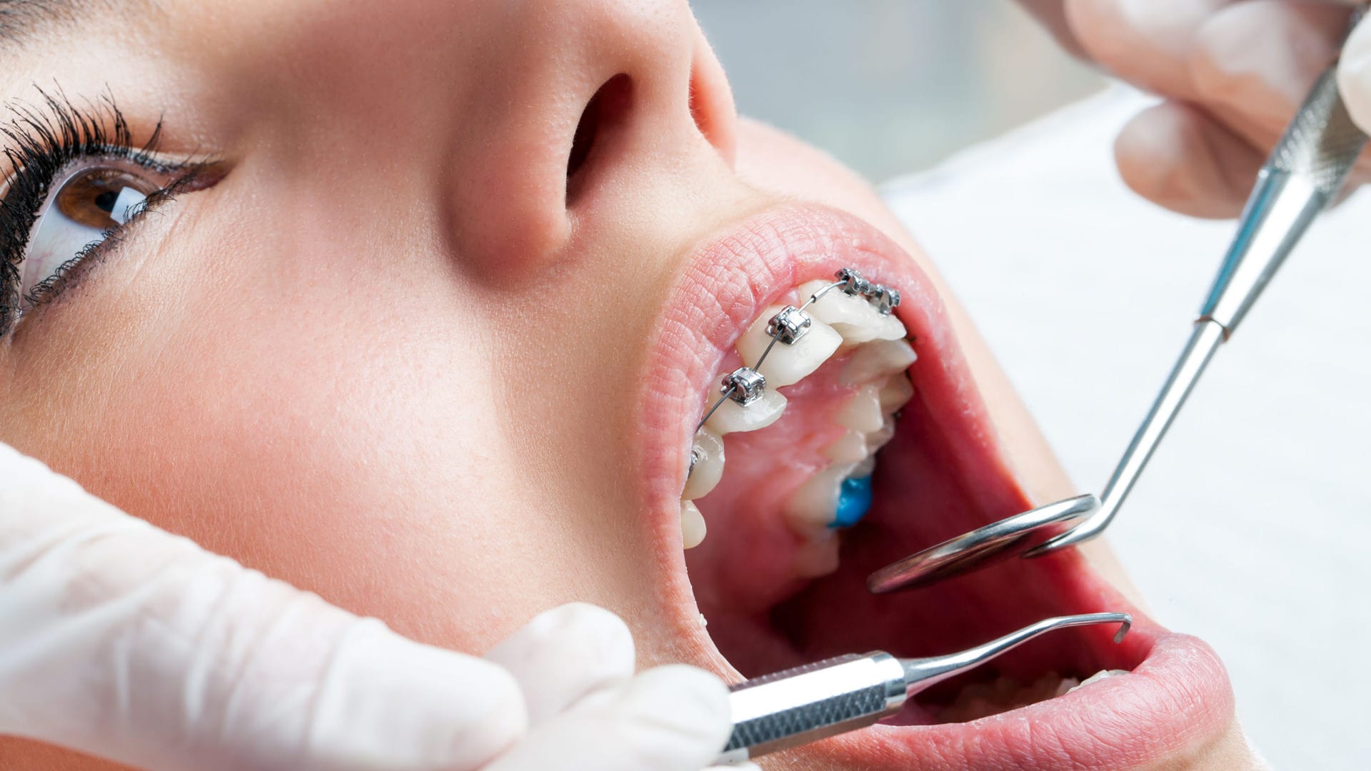 Orthodontic treatment secrets