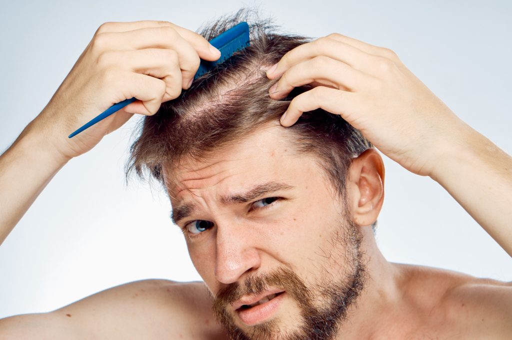 What Are The Three Types Of Hair Loss