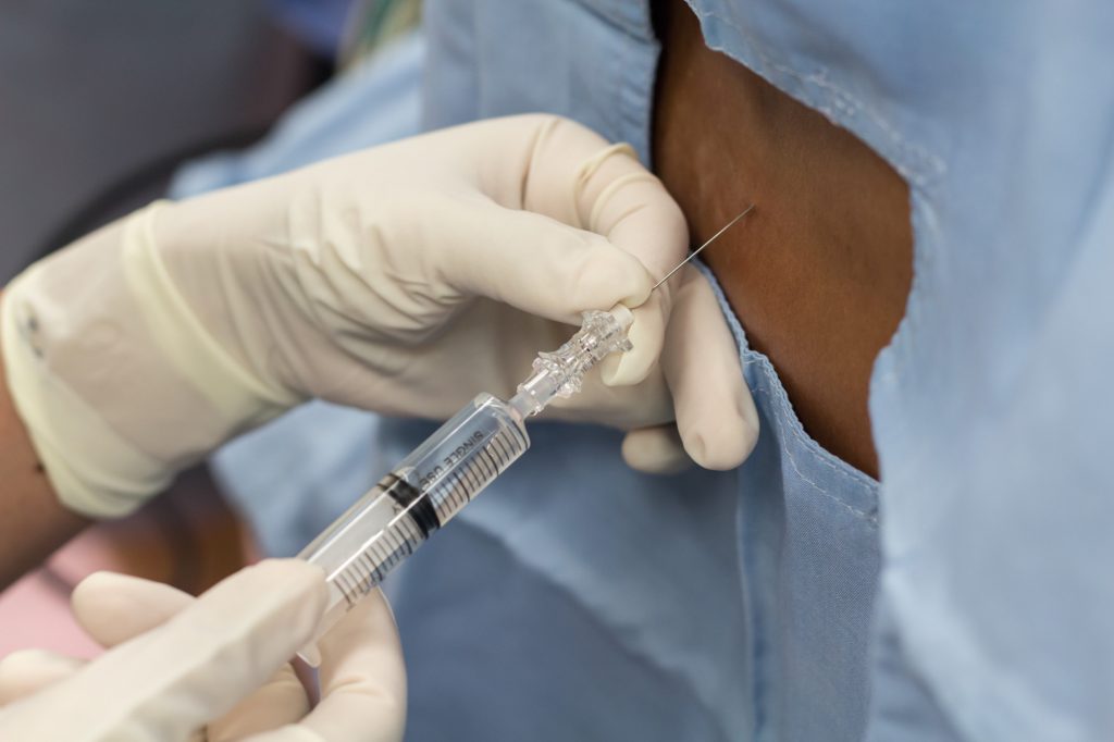 The Success Rate of Epidural Injections » Trending Us