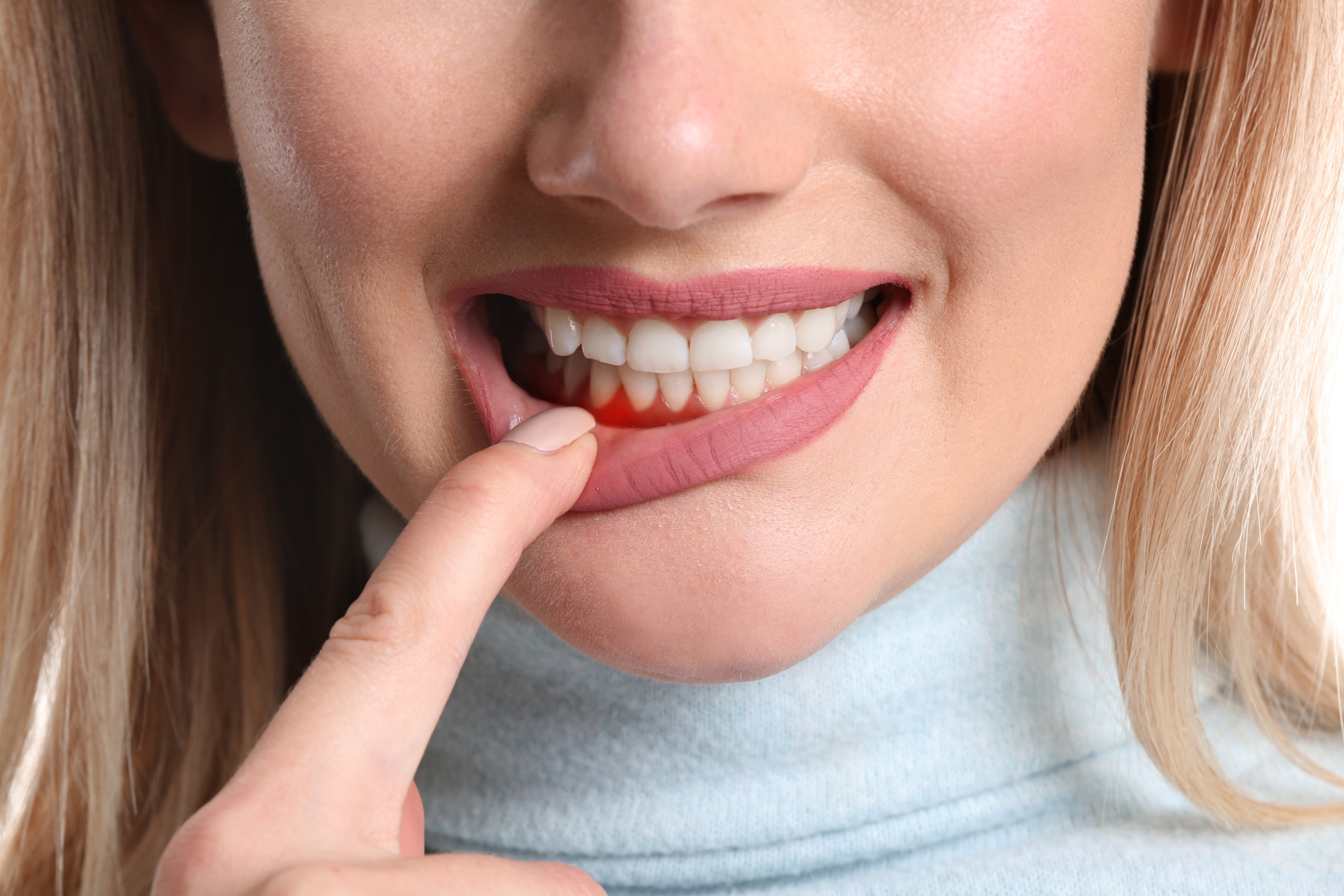 what-causes-bleeding-gums-trending-us